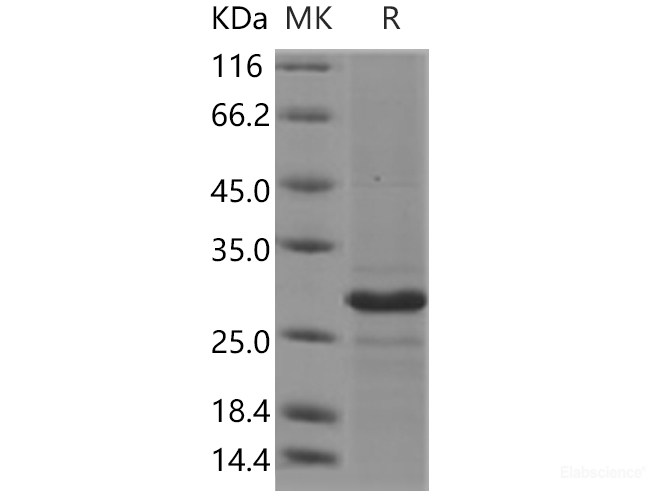 Recombinant Human CD20 / MS4A1 Protein (TrxA Tag)-Elabscience