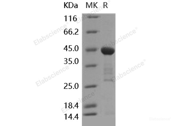 Recombinant Human IL18 / Interleukin 18 / IGIF Protein (GST tag)-Elabscience