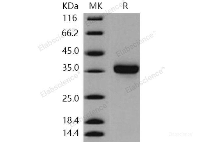 Recombinant Human KLK-8 / Kallikrein-8 Protein (His tag)-Elabscience
