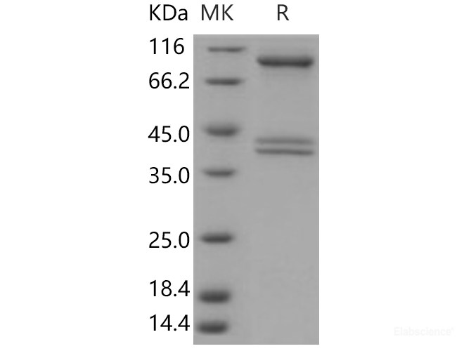 Recombinant Human AMPK (G1/B1/A2) Heterotrimer Protein-Elabscience
