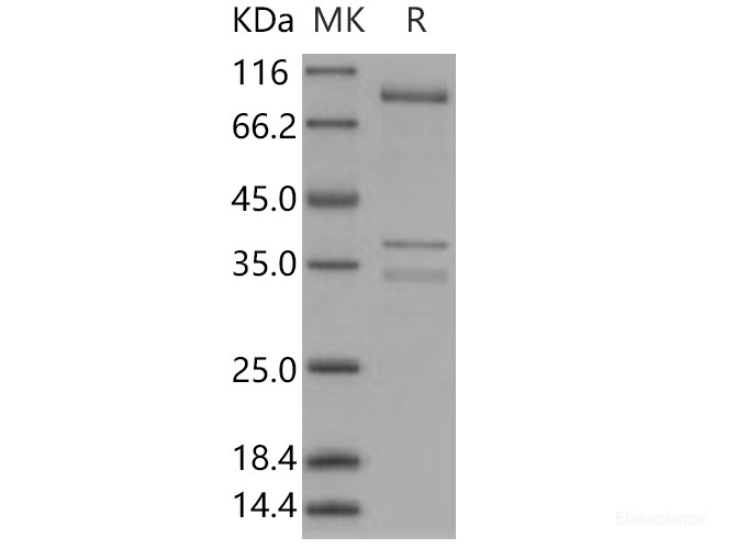 Recombinant Human AMPK (G1/B2/A1) Heterotrimer Protein-Elabscience