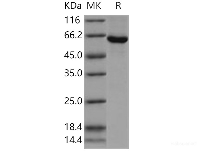 Recombinant Human SPHK1 / Sphingosine Kinase 1 Protein (His & GST tag)-Elabscience