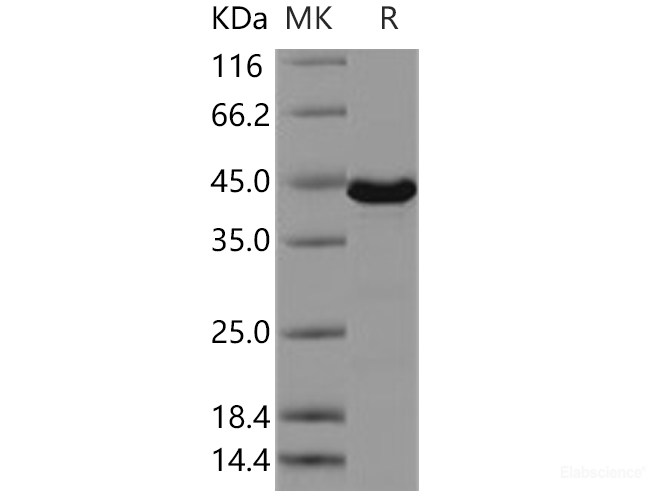Recombinant Human ERK3 / MAPK12 / P38-gamma Protein-Elabscience