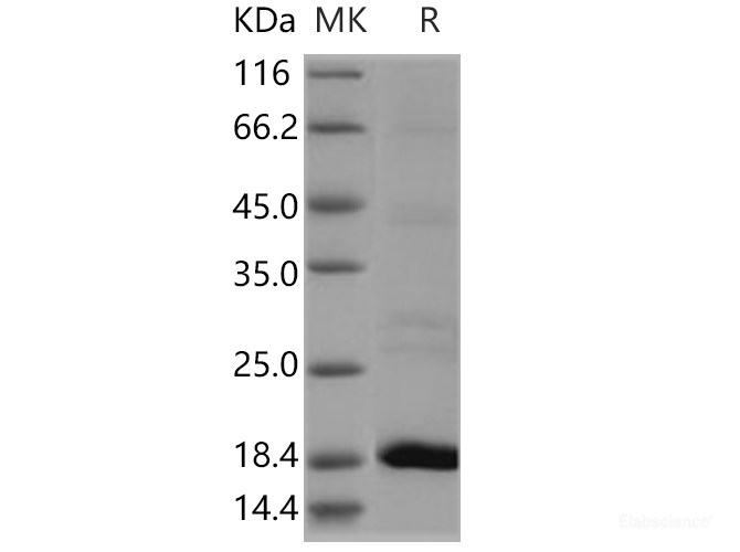 Recombinant Human Flavokinase / RFK Protein (His tag)-Elabscience