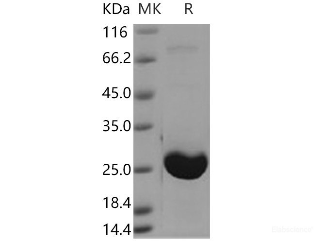 Recombinant Human AK1 / Adenylate kinase 1 Protein (His tag)-Elabscience