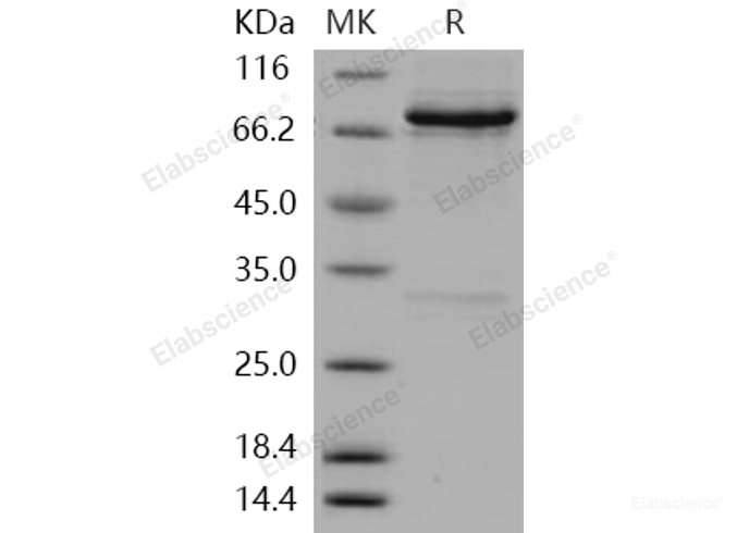 Recombinant Human RET Kinase Protein (aa 658-1114, His & GST tag)-Elabscience