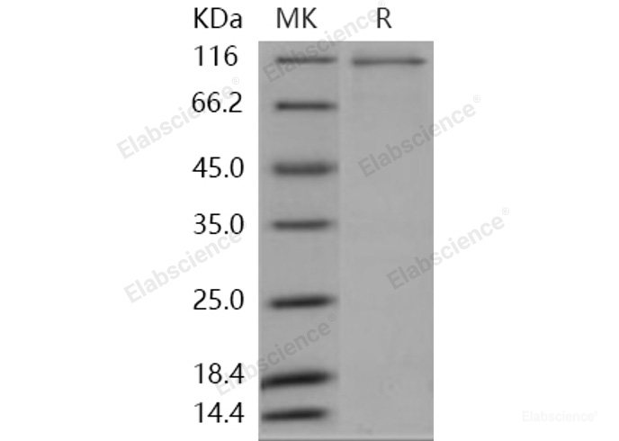 Recombinant Human MAP4K2 / GC Kinase Protein (His & GST tag)-Elabscience