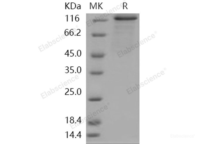Recombinant Human PRKD2 / PKD2 Protein (His & GST tag)-Elabscience