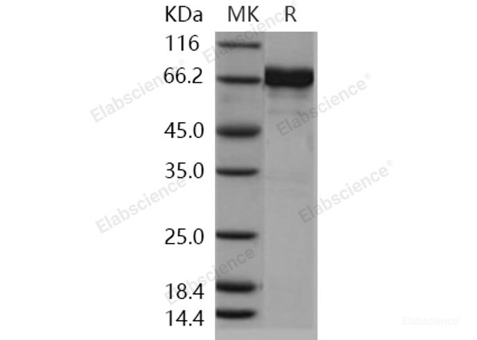 Recombinant Human EphA7 / EHK3 Protein (His & GST tag)-Elabscience