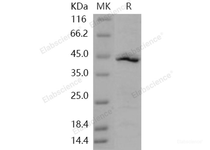 Recombinant Human IDO1 / IDO Protein (His tag)-Elabscience