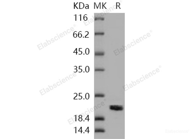 Recombinant Human NME1 / NDKA Protein (His tag)-Elabscience