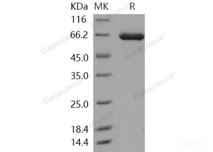 Recombinant Human TLK2 / PKU-ALPHA Protein (aa 397-772, His & GST tag)-Elabscience
