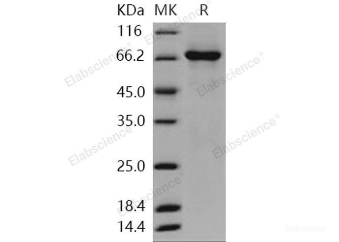 Recombinant Human TAOK3 / JIK / MAP3K18 Protein (aa 1-411, His & GST tag)-Elabscience