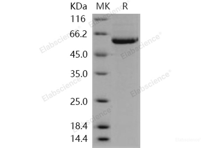 Recombinant Human STK4 / MST1 Protein (His tag)-Elabscience