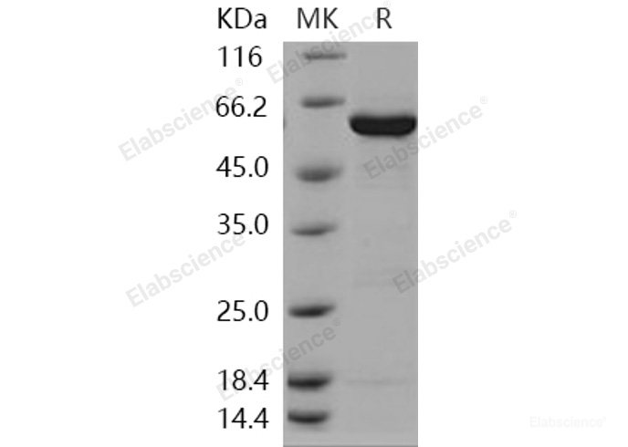 Recombinant Human GALK1 / Galactokinase / Galactose kinase Protein (His & GST tag)-Elabscience