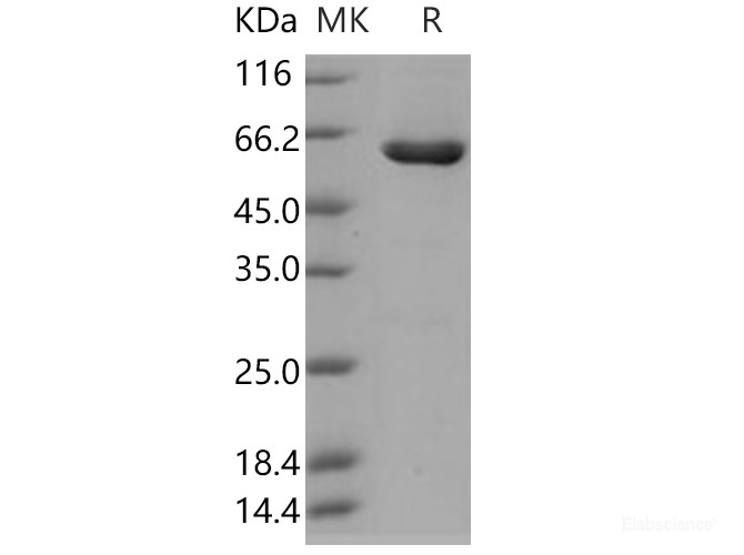 Recombinant Human CSNK2A2 / CK2A2 Protein (His & GST tag)-Elabscience