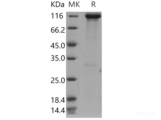 Recombinant Human Hexokinase-3 / HK3 Protein (His & GST tag)-Elabscience
