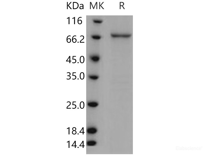 Recombinant Human TPL2 / MAP3K8 / MEKK8 Protein (GST tag)-Elabscience