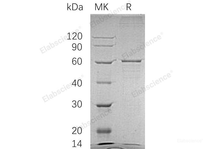 Recombinant Human BLK Protein (GST Tag)-Elabscience