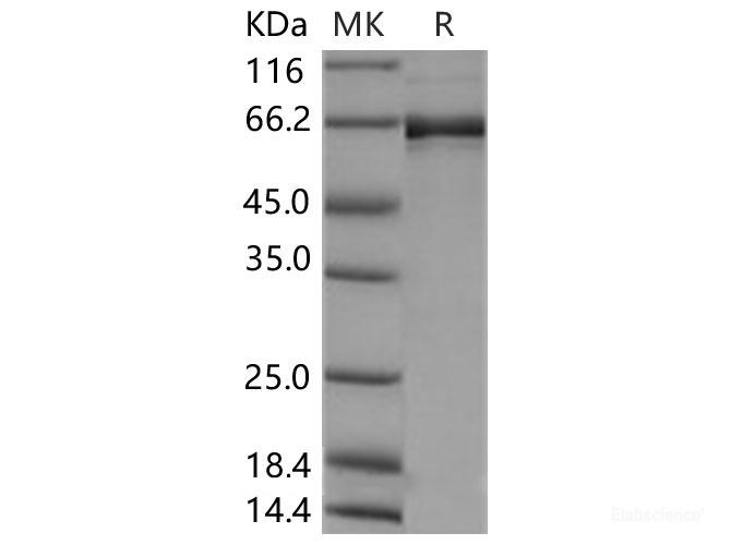 Recombinant Human EphB2 Protein (aa 570-987, His &GST Tag)-Elabscience