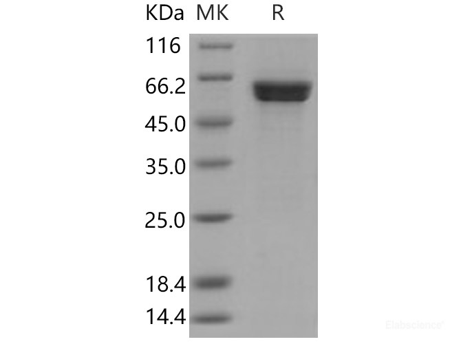 Recombinant Human CAMK1D / CKLiK Protein (GST tag)-Elabscience