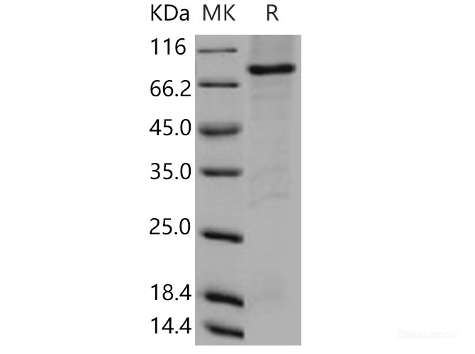Recombinant Human DYRK3 / REDK Protein (His & GST tag)-Elabscience