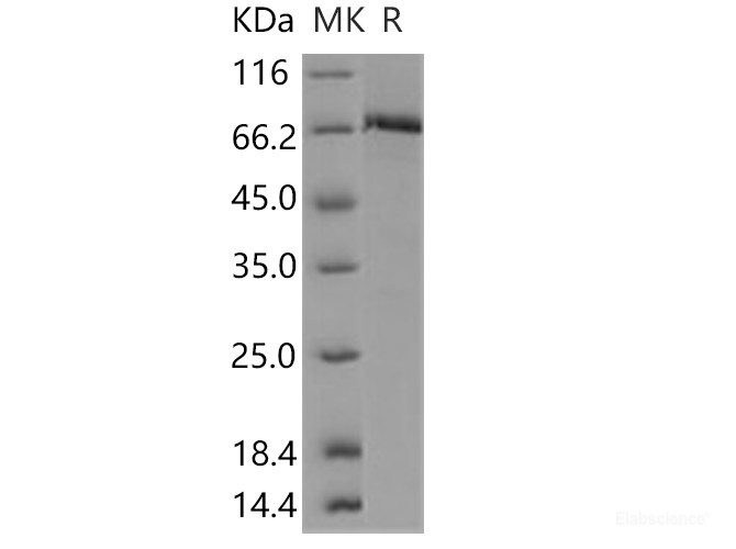 Recombinant Human c-MET / HGFR Protein (aa 956-1390, His & GST tag)-Elabscience