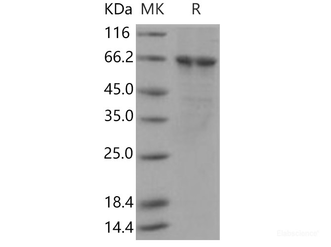 Recombinant Human PLK1 / PLK-1 Protein (His tag)-Elabscience
