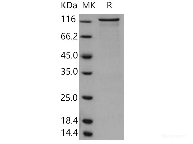 Recombinant Human PKC nu / PRKD3 Protein (GST tag)-Elabscience