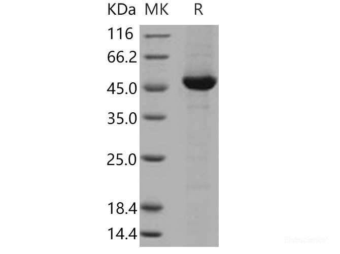 Recombinant Human DOPA Decarboxylase / DDC Protein (His tag)-Elabscience