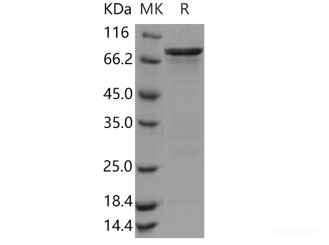 Recombinant Human CHK1 / CHEK1 Protein (GST tag)-Elabscience