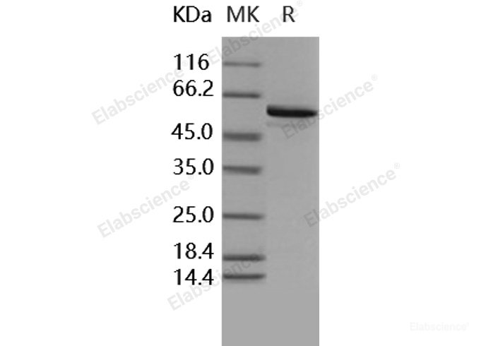 Recombinant Human BMPR1B / ALK-6 (149-502) Protein (His & GST tag)-Elabscience