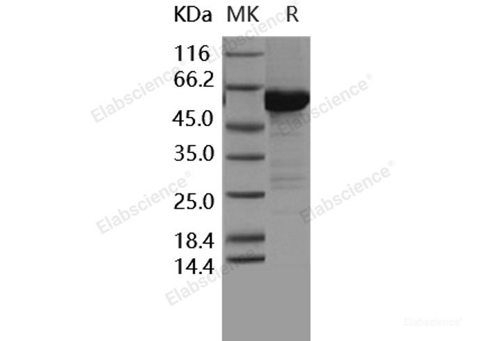 Recombinant Human MKK6 / MEK6 / MAP2K6 Protein (207 Ser/Asp, 211 Thr/Asp, His & GST tag)-Elabscience