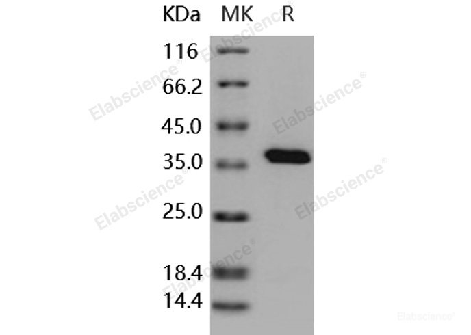 Recombinant Human PTP1B / PTPN1 Protein (His Tag)-Elabscience