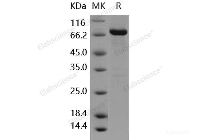 Recombinant Human DDR2 Kinase / CD167b Protein (aa 422-855, His & GST tag)-Elabscience
