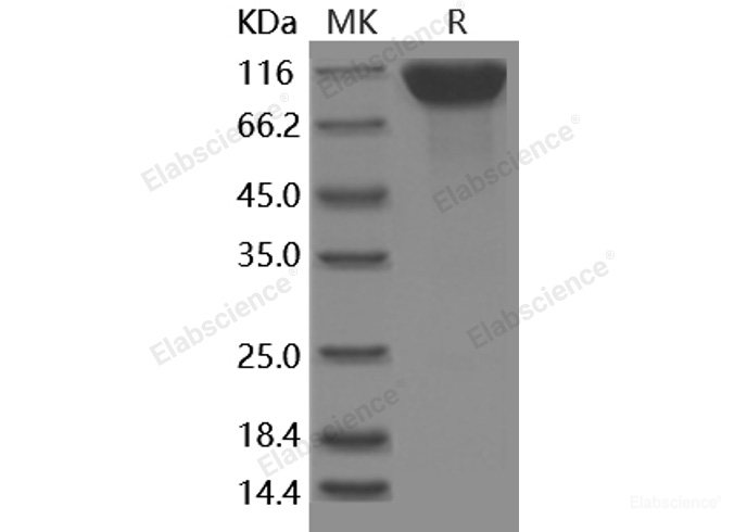 Recombinant Human CD6 / Cluster of Differentiation 6 Protein (Fc Tag)-Elabscience