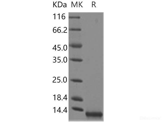 Recombinant Human CCL8 / MCP-2 Protein (His Tag)-Elabscience