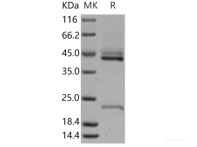 Recombinant Human IL-23 P19 Protein(His Tag)-Elabscience