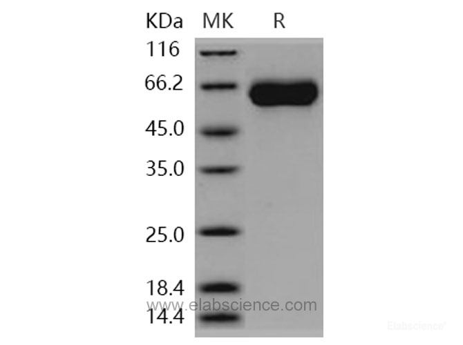 Recombinant Human MGAT5 / GGNT5 Protein (His tag)-Elabscience