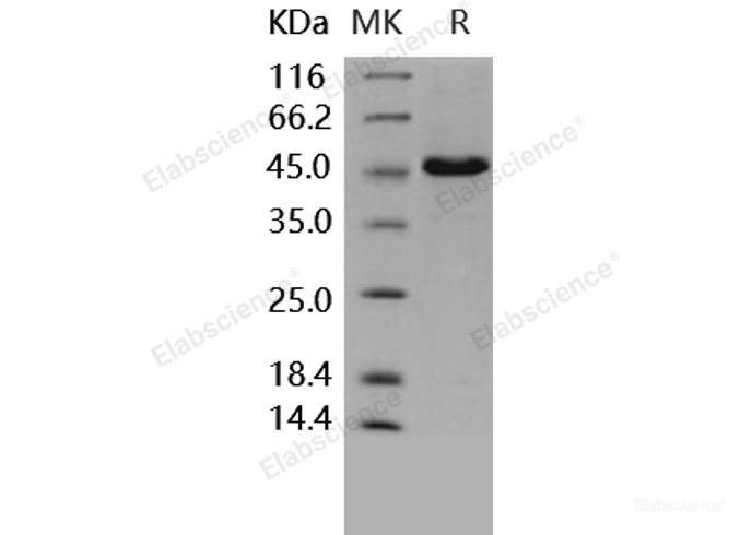 Recombinant Human CD4 / LEU3 Protein (His tag)-Elabscience