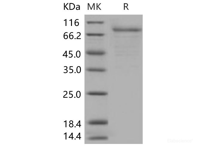Recombinant Human GM-CSF Receptor alpha Protein (Fc Tag)-Elabscience