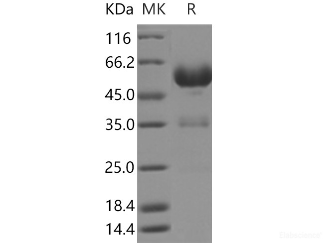 Recombinant Human LAIR1 Protein (Fc Tag)-Elabscience