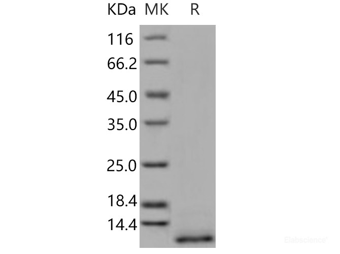 Recombinant Human CD9 / Tspan-29 Protein (His tag)-Elabscience