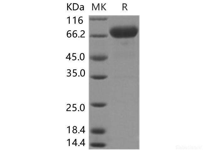 Recombinant Human IL-12 (IL12A &IL12B Heterodimer) Protein (His Tag)-Elabscience