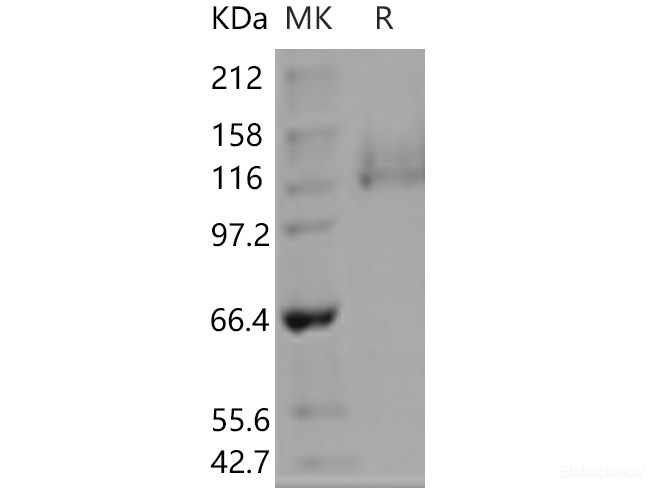 Recombinant Human ITGA6 & ITGB1 Heterodimer Protein-Elabscience