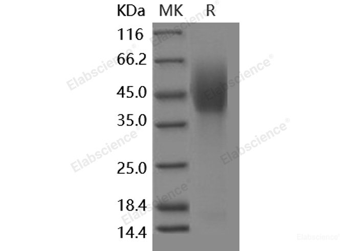 Recombinant Human NPC1 Protein (His & FLAG Tag)-Elabscience