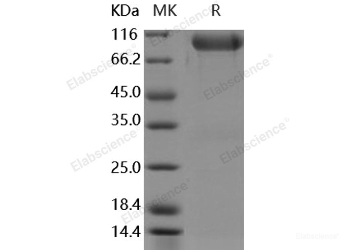 Recombinant Human FGFR3 / CD333 Protein (alpha(IIIb), Fc Tag)-Elabscience