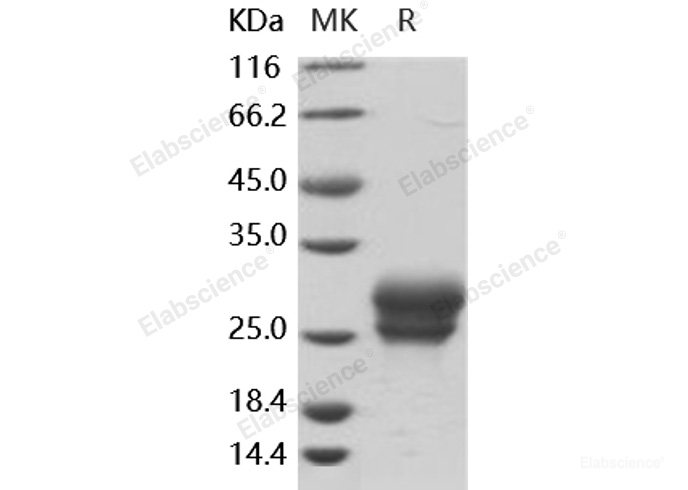Recombinant Human Frizzled-4 / FZD4 / CD344 Protein (His Tag)-Elabscience