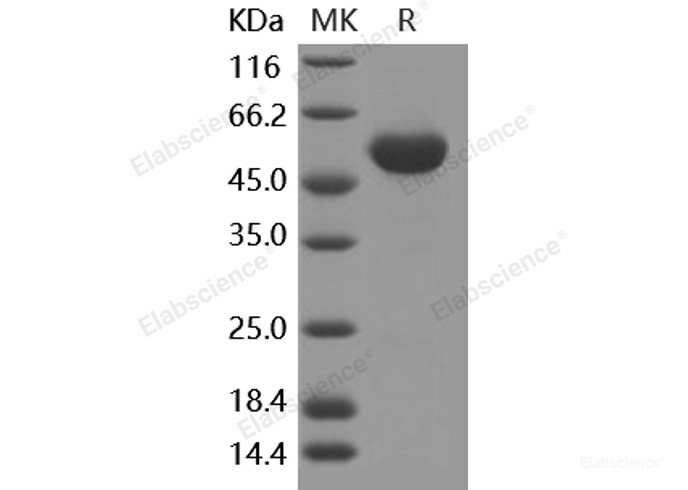 Recombinant Human Frizzled-4 / FZD4 / CD344 Protein (Fc tag)-Elabscience