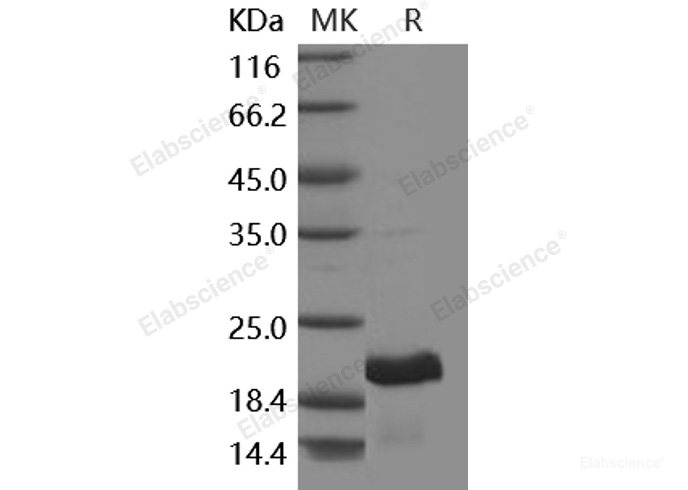 Recombinant Human GH1 / Growth hormone 1 Protein-Elabscience